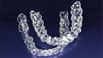 Clínica dental: ortodoncia invisible