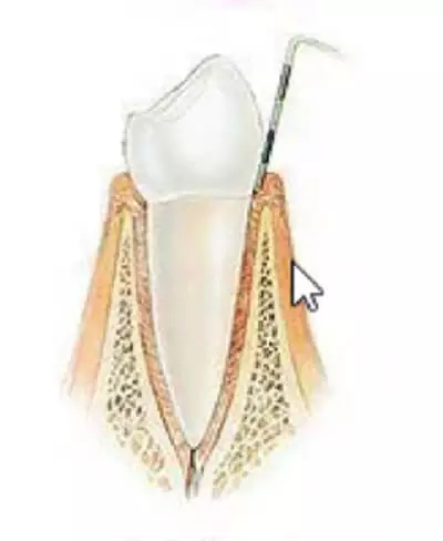 Periodoncia en Alcorcón